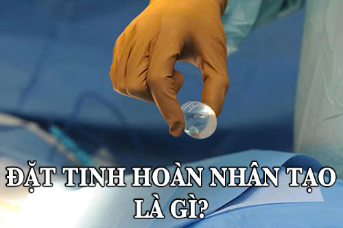 Tìm hiểu đặt tinh hoàn nhân tạo là gì
